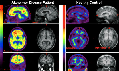 petscan petscan